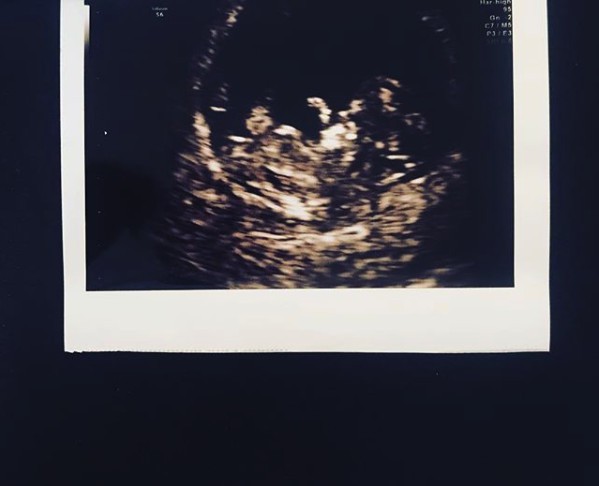 Screen Shot 2017-12-27 at 6.56.05 PM