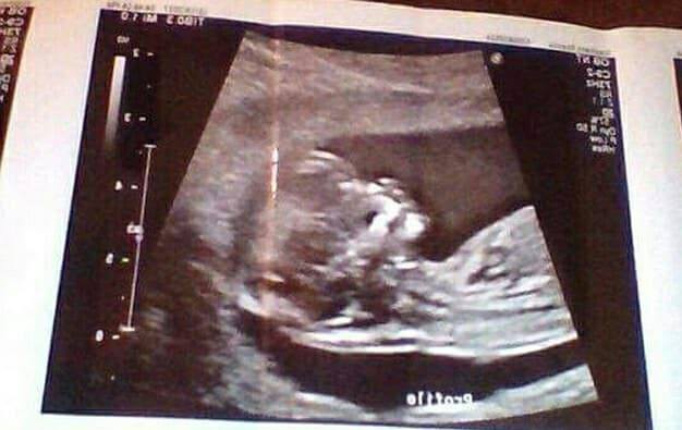 26169897_10155987884333769_7434193981010181653_n