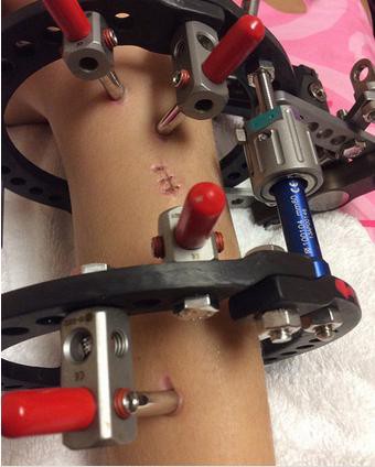 28890002n1235so15qn5