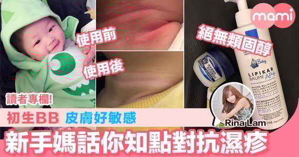 【初生BB皮膚好敏感 新手媽話你知點對抗濕疹】