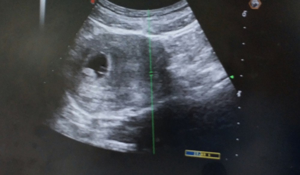 Screenshot_20180218-192023