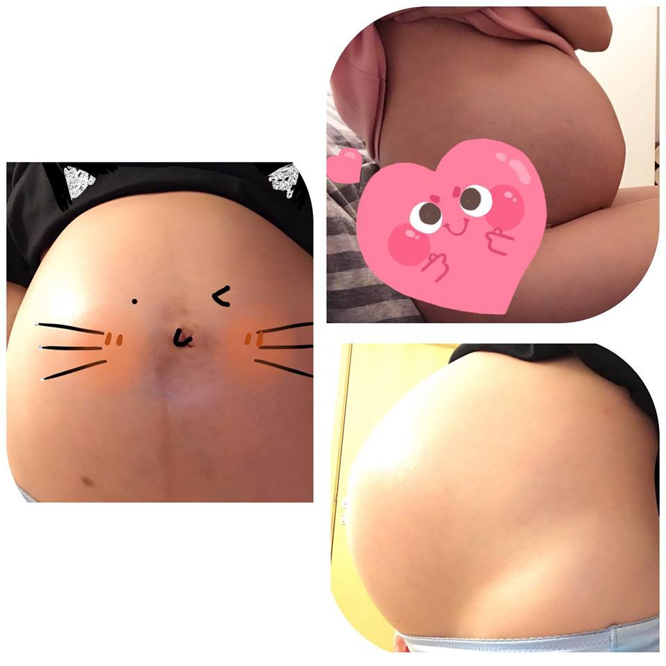 28722194_207707129811137_1954591167_n