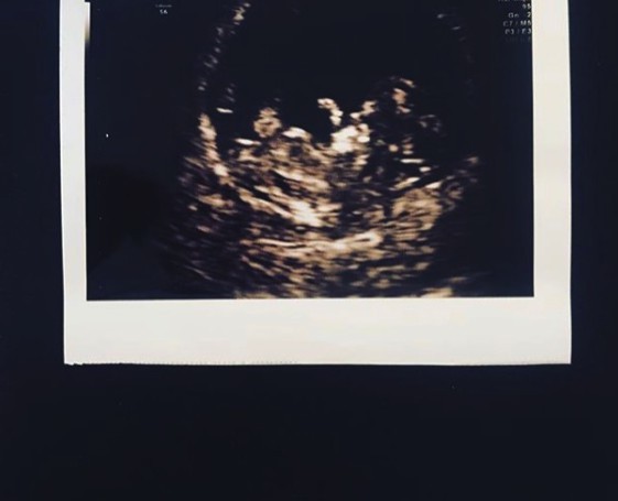 Screen Shot 2018-03-15 at 7.25.26 PM