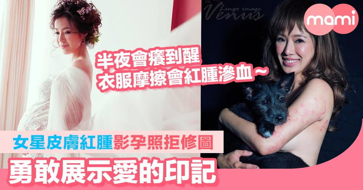 台灣女星最美孕照  皮膚紅腫影孕照拒修圖    勇敢展示愛的印記  懷孕會造成女人身體永遠破壞，但不可怕
