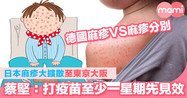 德國麻疹VS麻疹分別 日本麻疹大擴散至東京大阪  蔡堅：打疫苗至少一星期才會見效