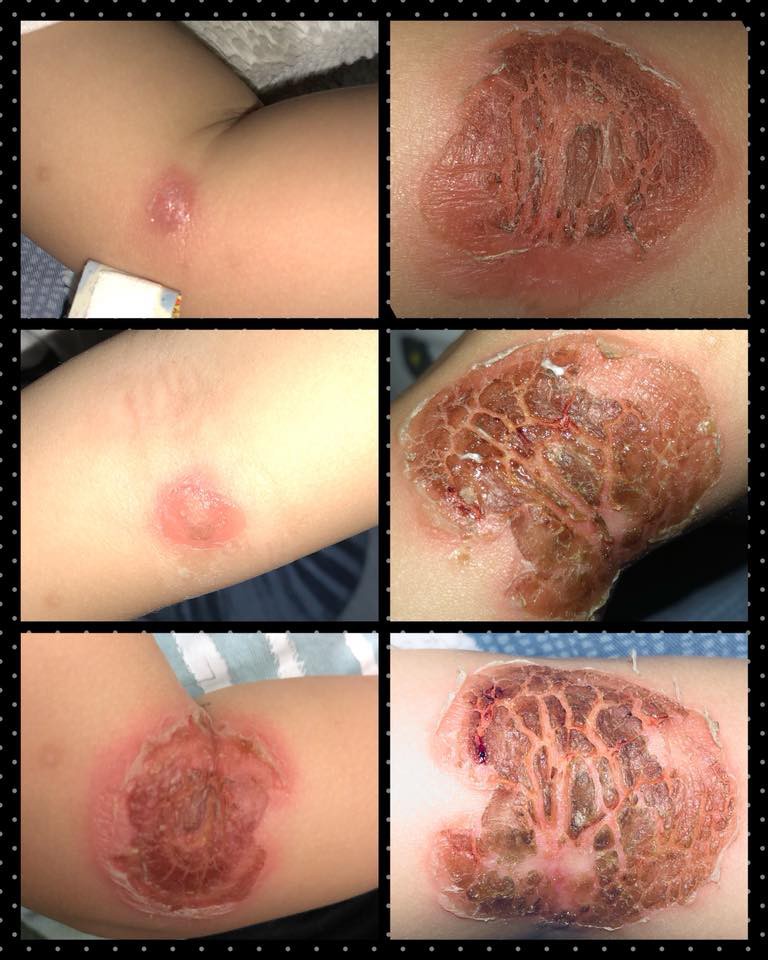 32392151_10156319976447438_7721538680589910016_n