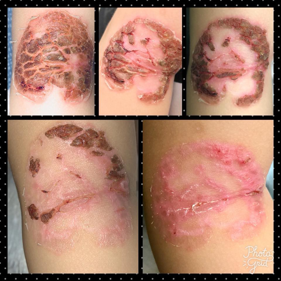 32469500_10156319980542438_596443259446755328_n