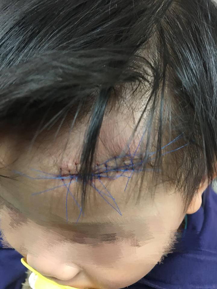 32476690_638791996462979_903095841252704256_n