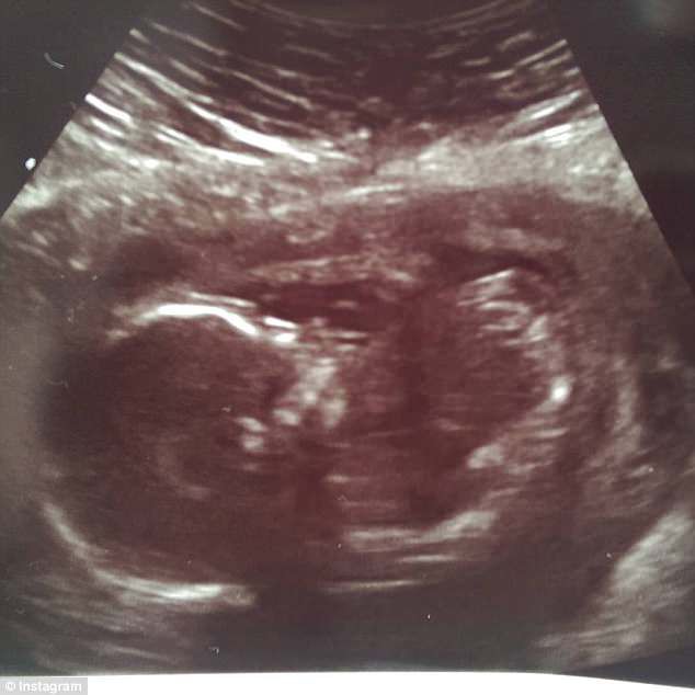 4BF7D97500000578-5702975-image-a-20_1525772931926