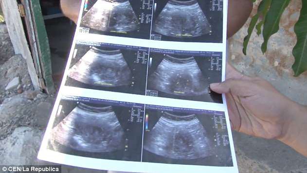 4C7E5A8300000578-5753051-Maria_de_la_Luz_has_shown_reporters_ultrasound_scans_which_she_s-a-28_1526914030624