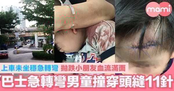 巴士急轉彎男童撞穿頭縫11針 上車未坐穩急轉彎 拋跌小朋友血流滿面