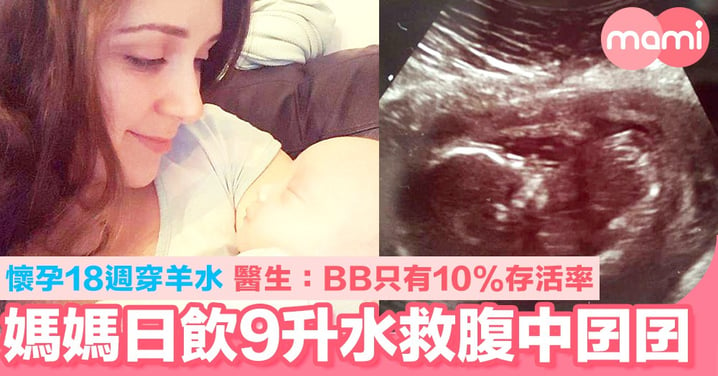 媽媽日飲9公升水救活腹中囝囝！ 懷孕18週穿羊水 醫生：BB只有10%存活率