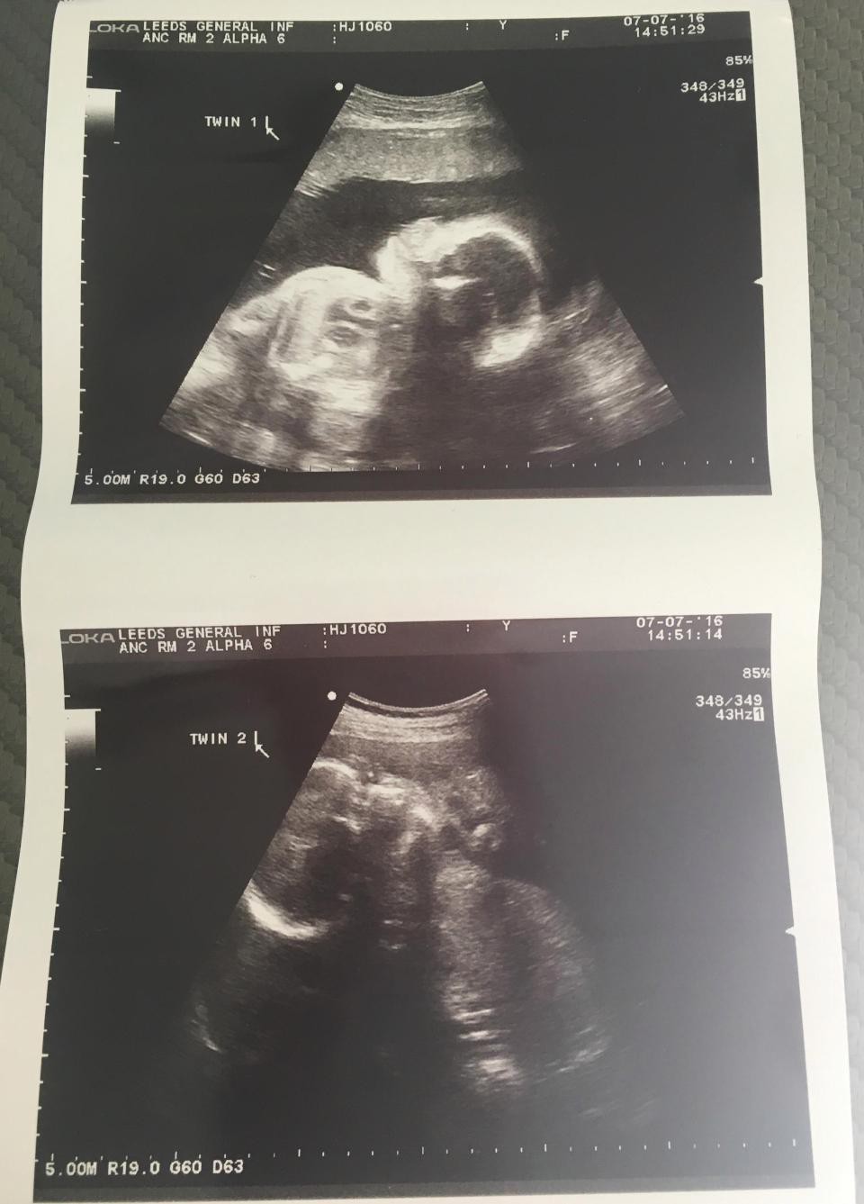 nintchdbpict0004083179572