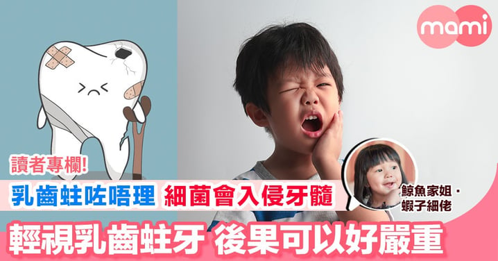 【乳齒蛀咗唔洗理？ 深入牙根會影響仲未生出嘅恆齒架！】