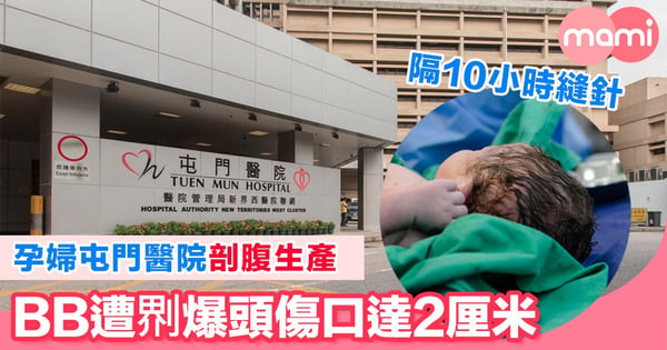 孕婦屯門醫院剖腹生產  BB遭?爆頭傷口2厘米  隔十小時縫針
