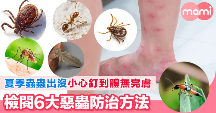 夏季蟲蟲出沒小心釘到體無完膚  檢閱6大惡蟲防治方法