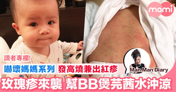 【玫瑰疹突襲】BB突然發高燒又出紅疹  嚇壞媽媽
