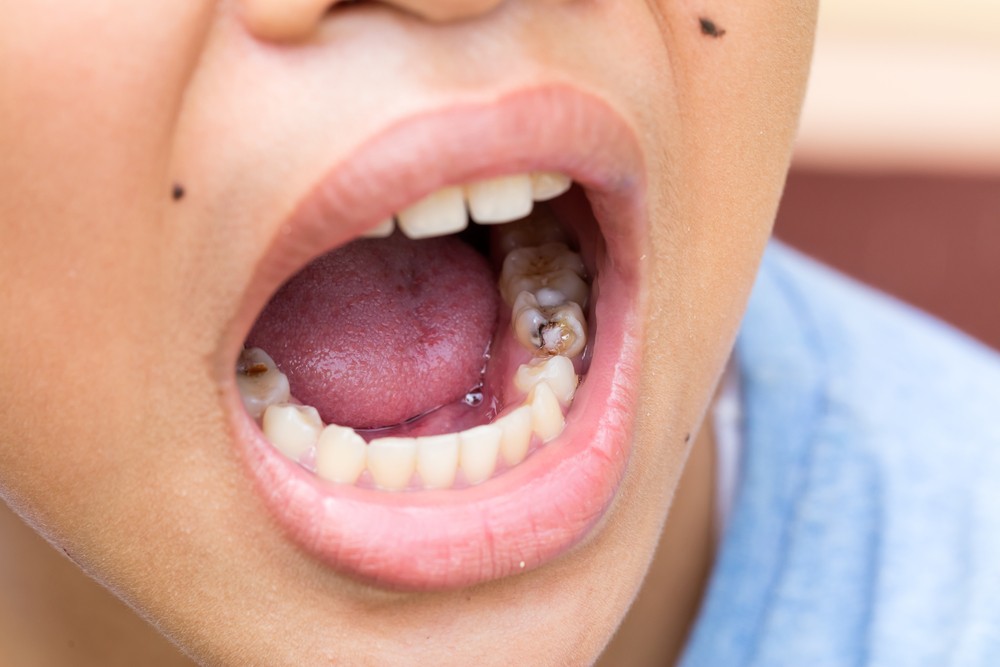 shutterstock_326602352