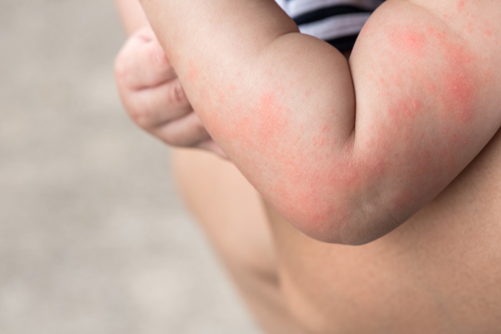 shutterstock_748595473