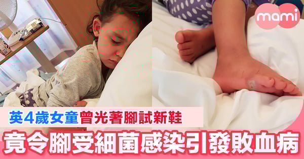 英4歲女童試新鞋後染上敗血病 母籲試新鞋前需穿襪