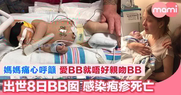 美國出生8天女嬰感染疱疹 媽媽痛心發文籲停止親吻小寶寶