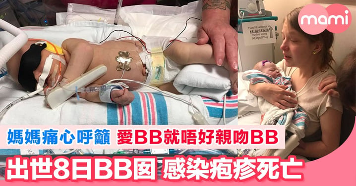 美國出生8天女嬰感染疱疹 媽媽痛心發文籲停止親吻小寶寶