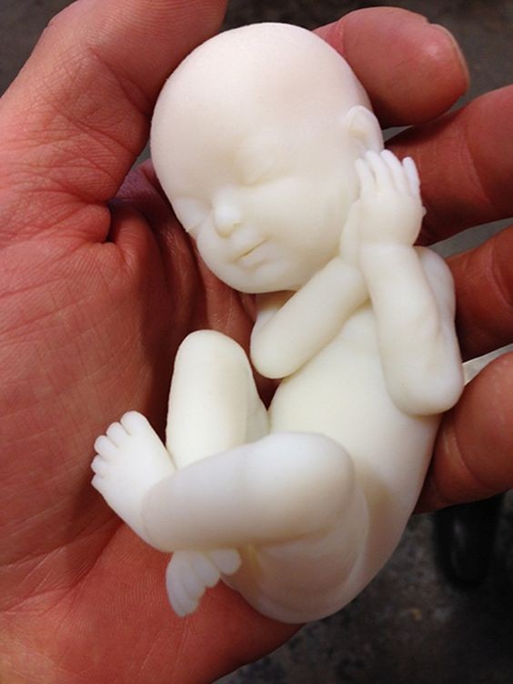 fetus_3Dprinting