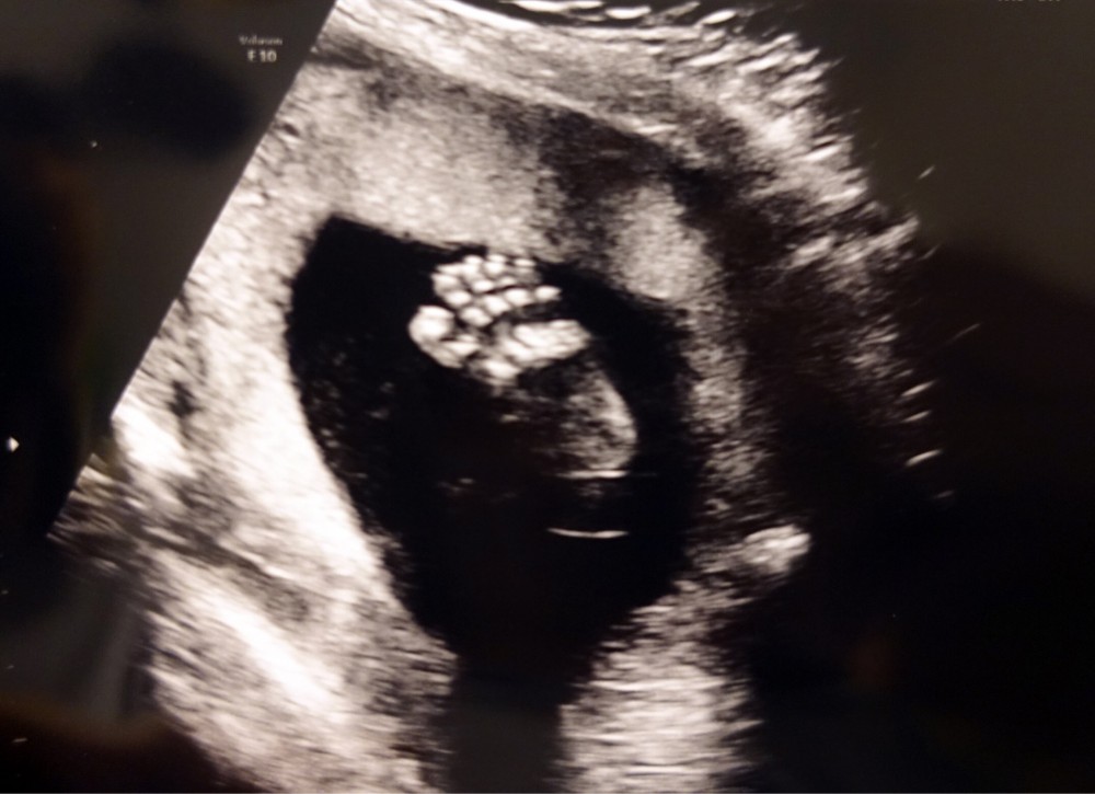 15445011297905IMG-1125