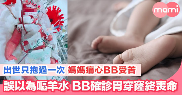 台灣BB確診胃穿窿 媽媽痛心提醒勿掉以輕心