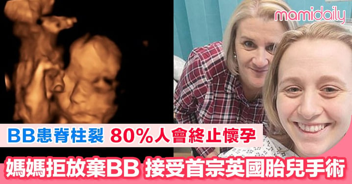 媽媽拒放棄懷孕 成功進行胎兒手術修補BB脊髓