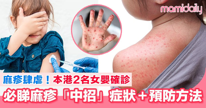 香港麻疹肆虐 2名女嬰確診！媽媽必睇「中招」症狀＋預防方法