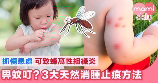 畀蚊叮 愈搲愈痕?3大快速止痕方法