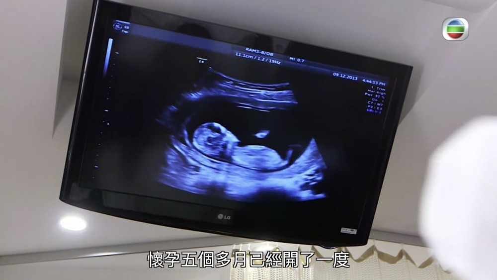 無綫電視截圖