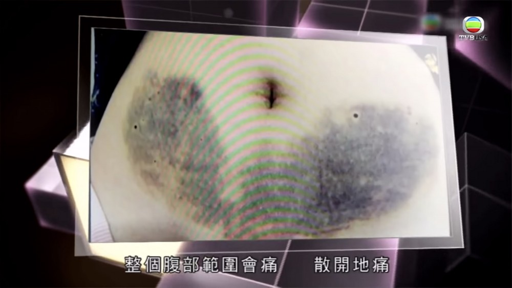 無綫電視截圖