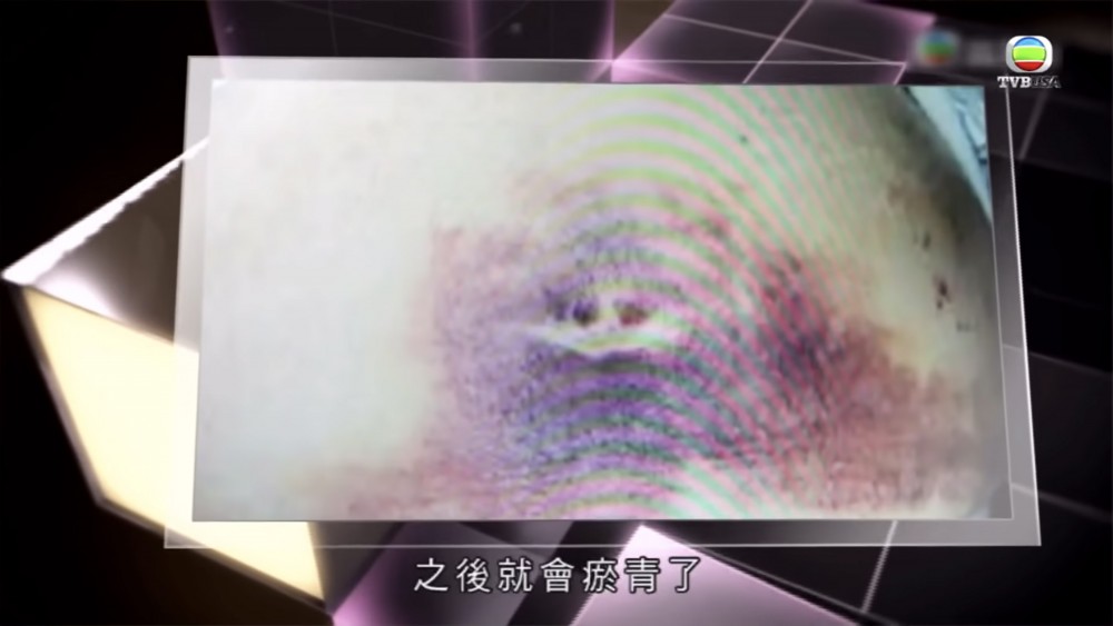 無綫電視截圖