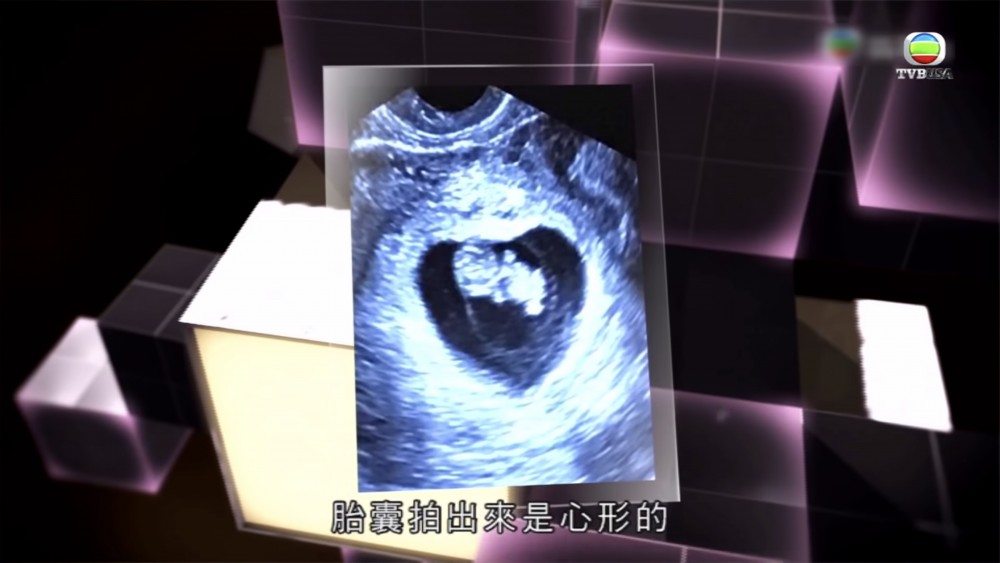 無綫電視截圖