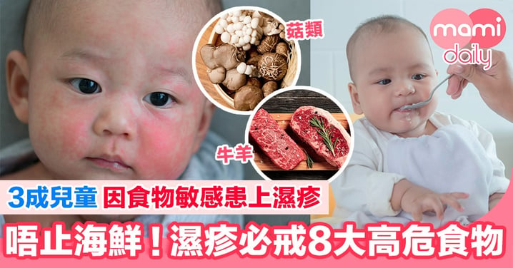 3成兒童因食物敏感患濕疹 愈食愈痕！8大必戒食物