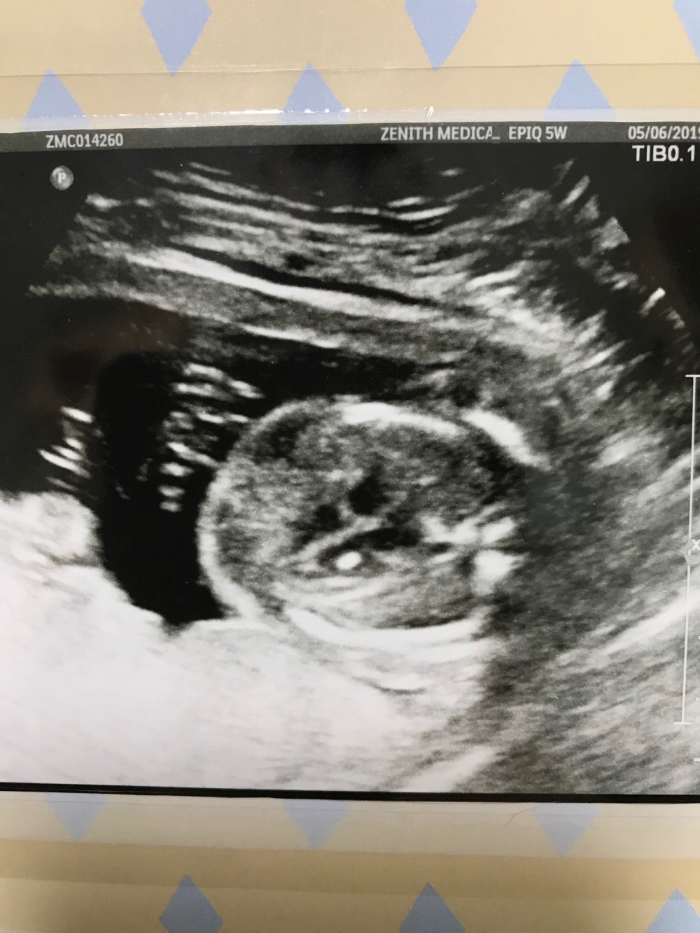 15623995737206image1 2