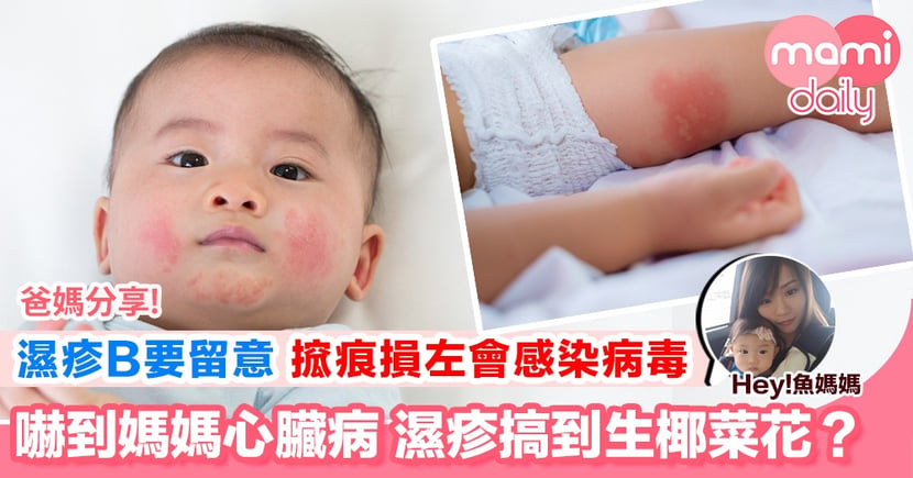 嚇壞媽媽系列珍珠疣 椰菜花 Mamidaily 親子日常