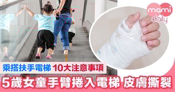 5歲女童手臂捲入電梯 皮膚撕裂！內附搭電梯注意事項