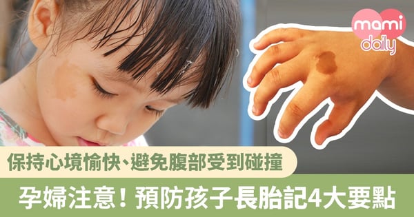 寶寶長胎記的原因+懷孕期間如何避免