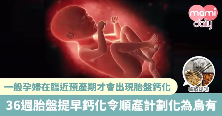 【懷孕期】令人提心吊膽的胎盤鈣化