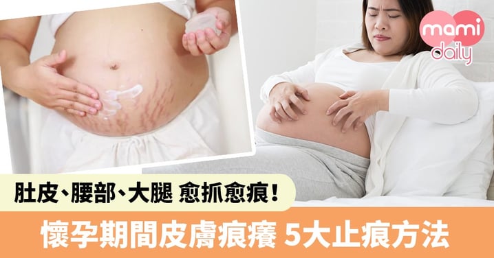 【妊娠蕁麻疹】懷孕期間皮膚愈抓愈痕？孕媽必學！5大止痕方法