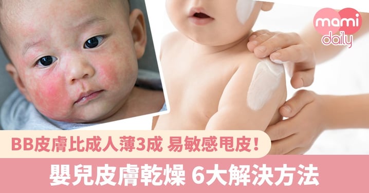 【皮膚乾燥】天氣轉冷 又乾又痕？6招解決嬰兒皮膚乾燥問題