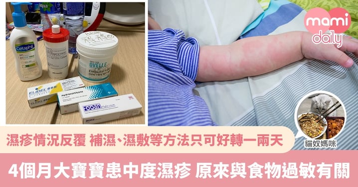 【BB濕疹】皮膚反覆變差有機會患濕疹 成因更可能與食物過敏有關