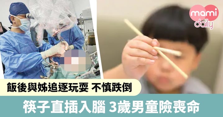 3歲男童飯後追逐玩耍跌倒 筷子插入腦險喪命