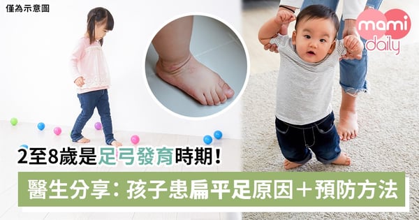 2至8歲是足弓發育時期! 醫生分享小朋友患扁平足原因+預防方法