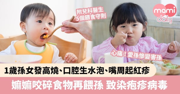 【幼兒健康】1歲孫女染疱疹病毒發高燒、口腔生水泡、嘴周起紅疹　全因與嫲嫲咬碎食物再餵食有關？