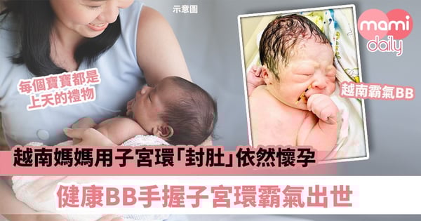 【命運之子】越南媽媽用子宮環「封肚」依然懷孕 健康BB手握子宮環霸氣出世