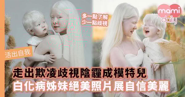 【活出自我】走出欺凌歧視陰霾成模特兒 白化病姊妹絕美照片展現自信美麗